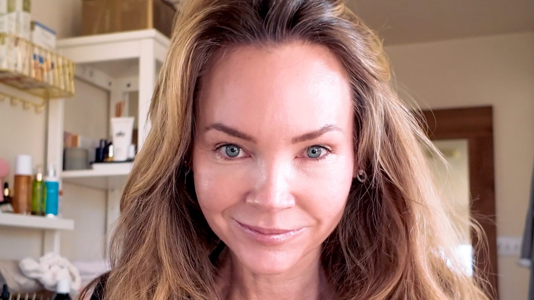 VBEAM LASER BEFORE AND AFTER - treatment image