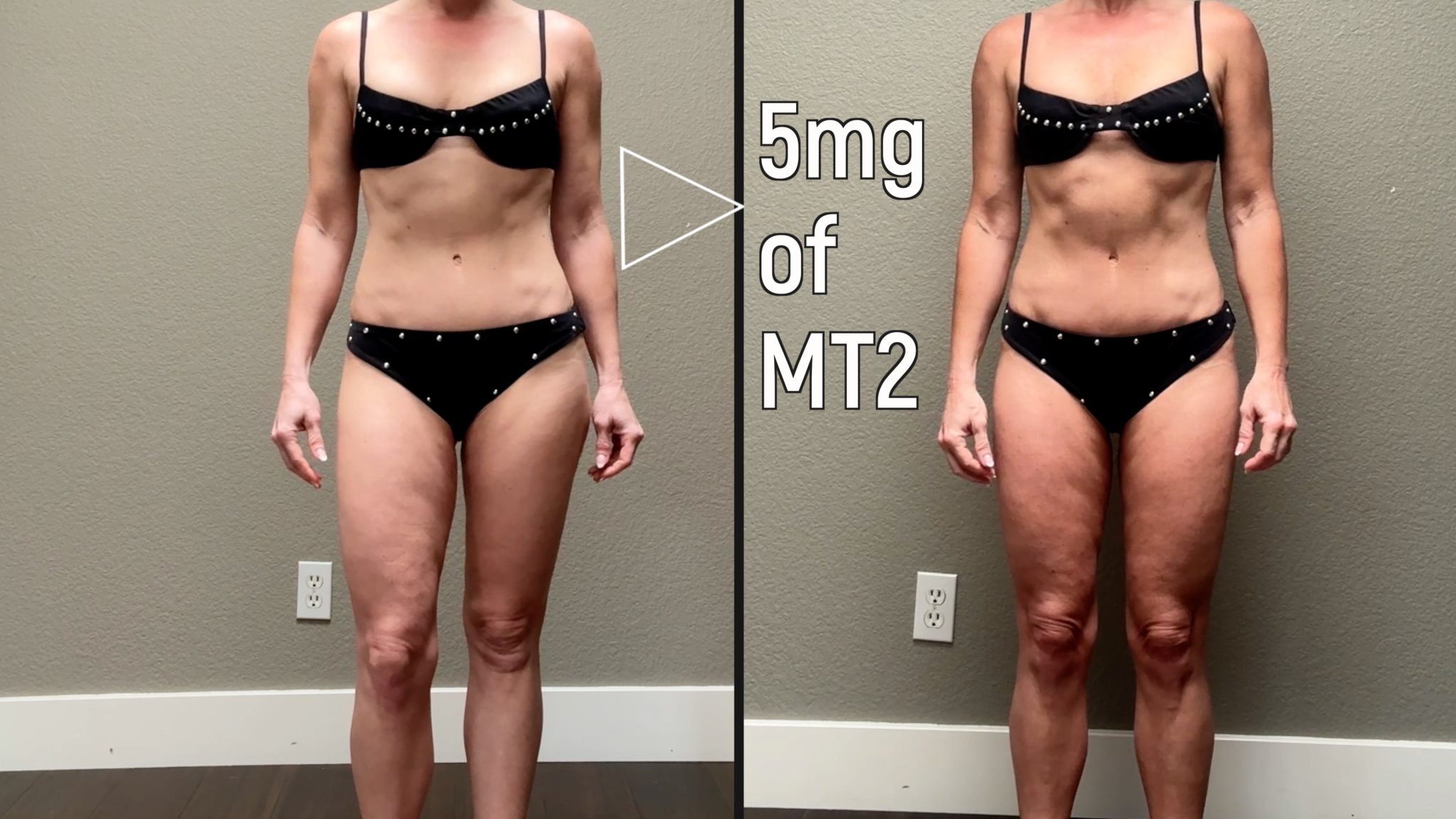 Get Your Glow On This Summer w/ Melanotan Tanning Peptides - treatment image