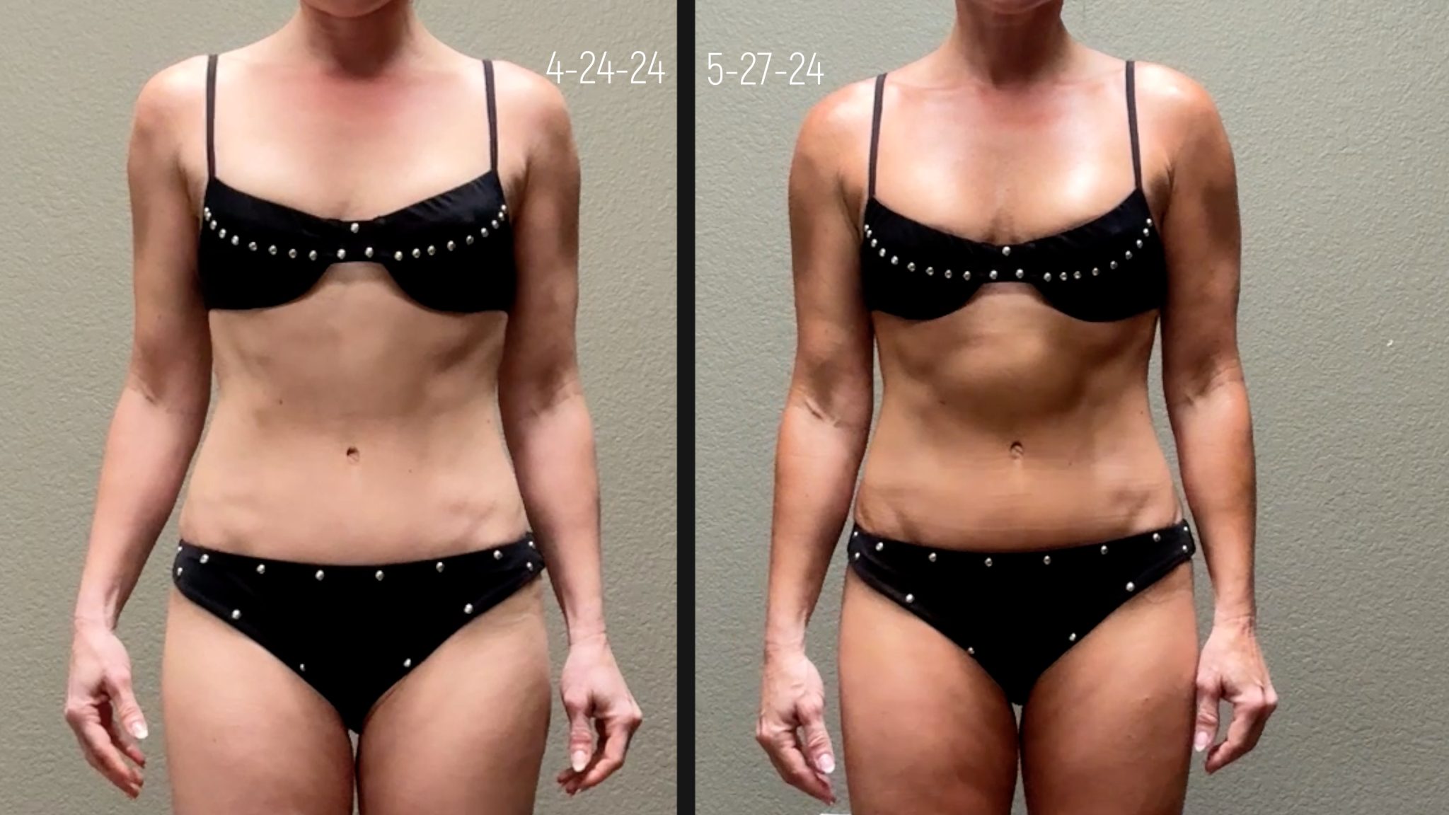 Get Your Glow On This Summer w/ Melanotan Tanning Peptides - treatment image