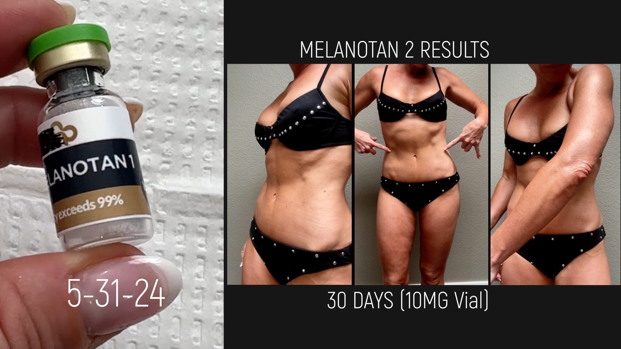 Get Your Glow On This Summer w/ Melanotan Tanning Peptides - treatment image