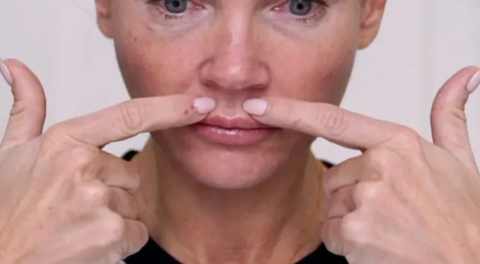 Do I Need a Facelift? Join Me for My Consultation Experience & Cost! - treatment image