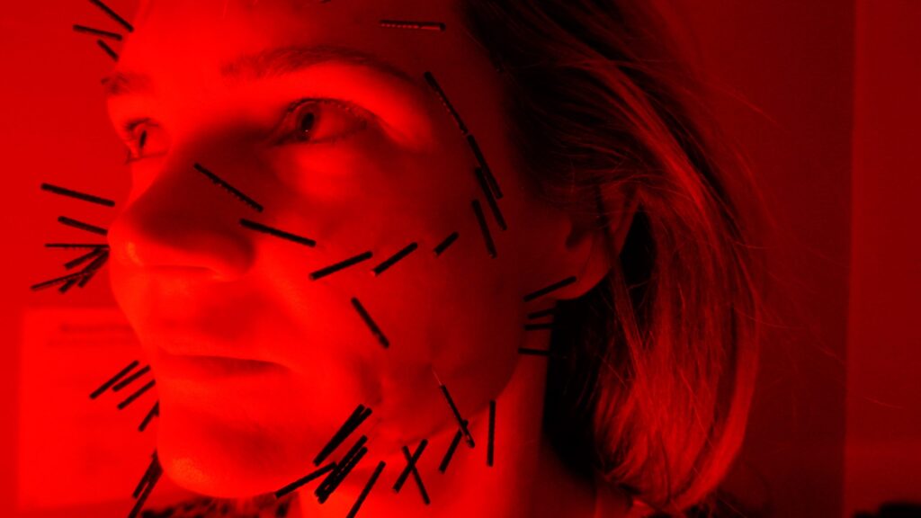 Facial Acupuncture