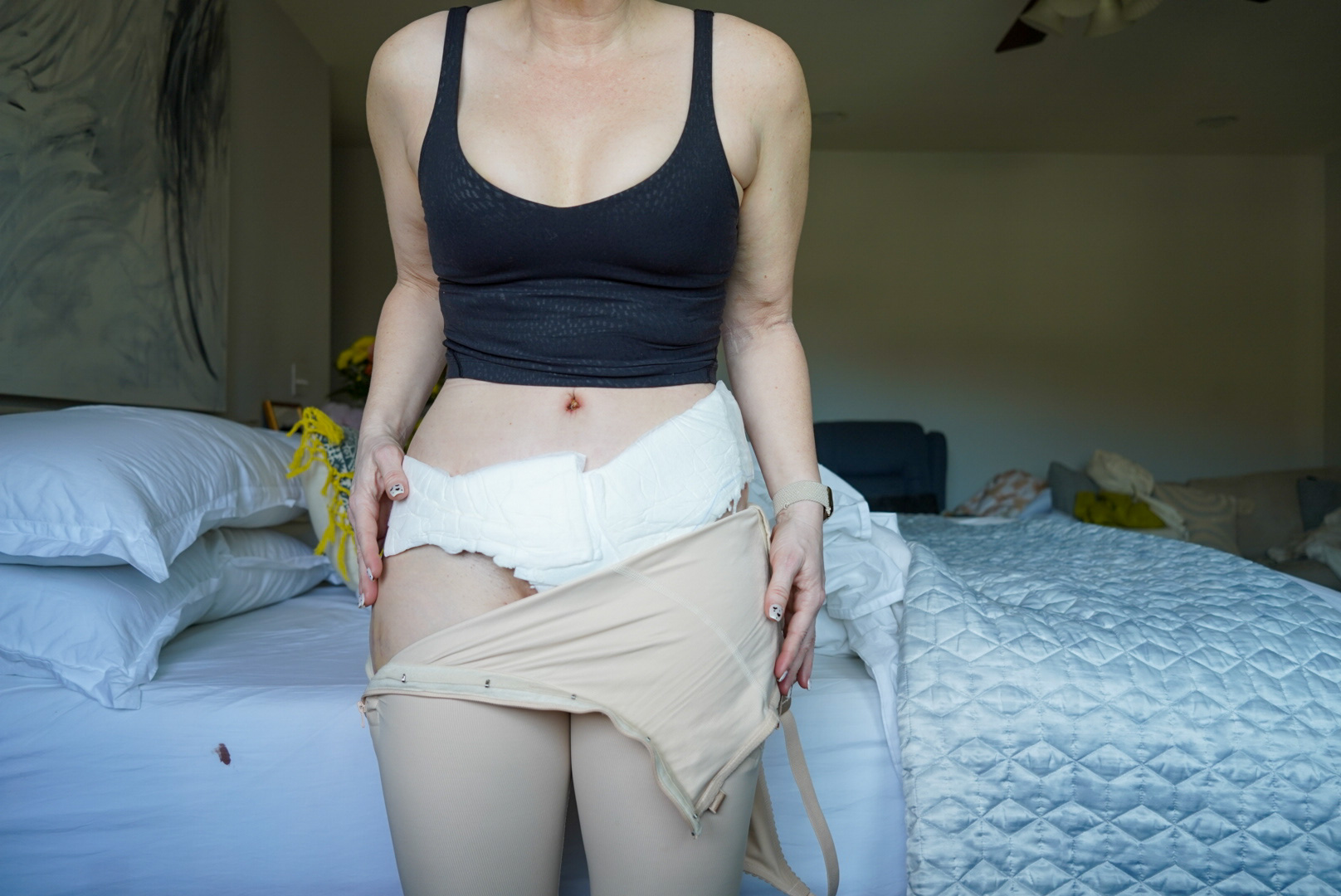 TUMMY TUCK POST OP NATURAL KAOS