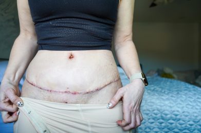 MOMMY MAKEOVER: SURGERY ROOM