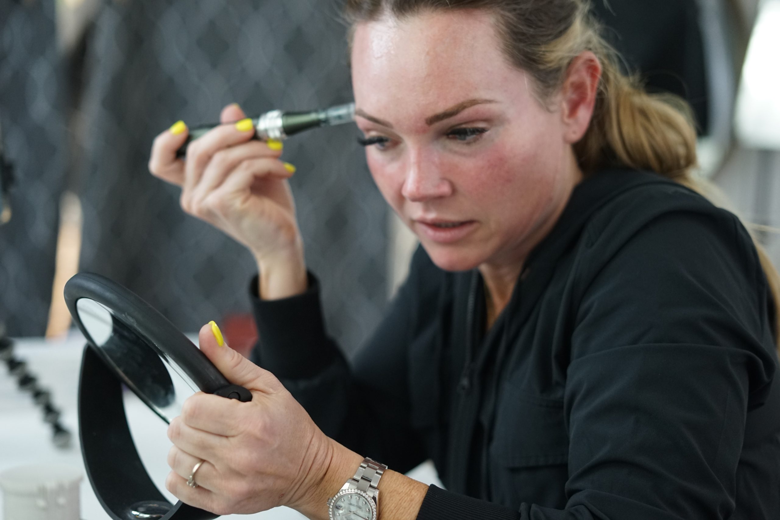 MICRONEEDLING 101