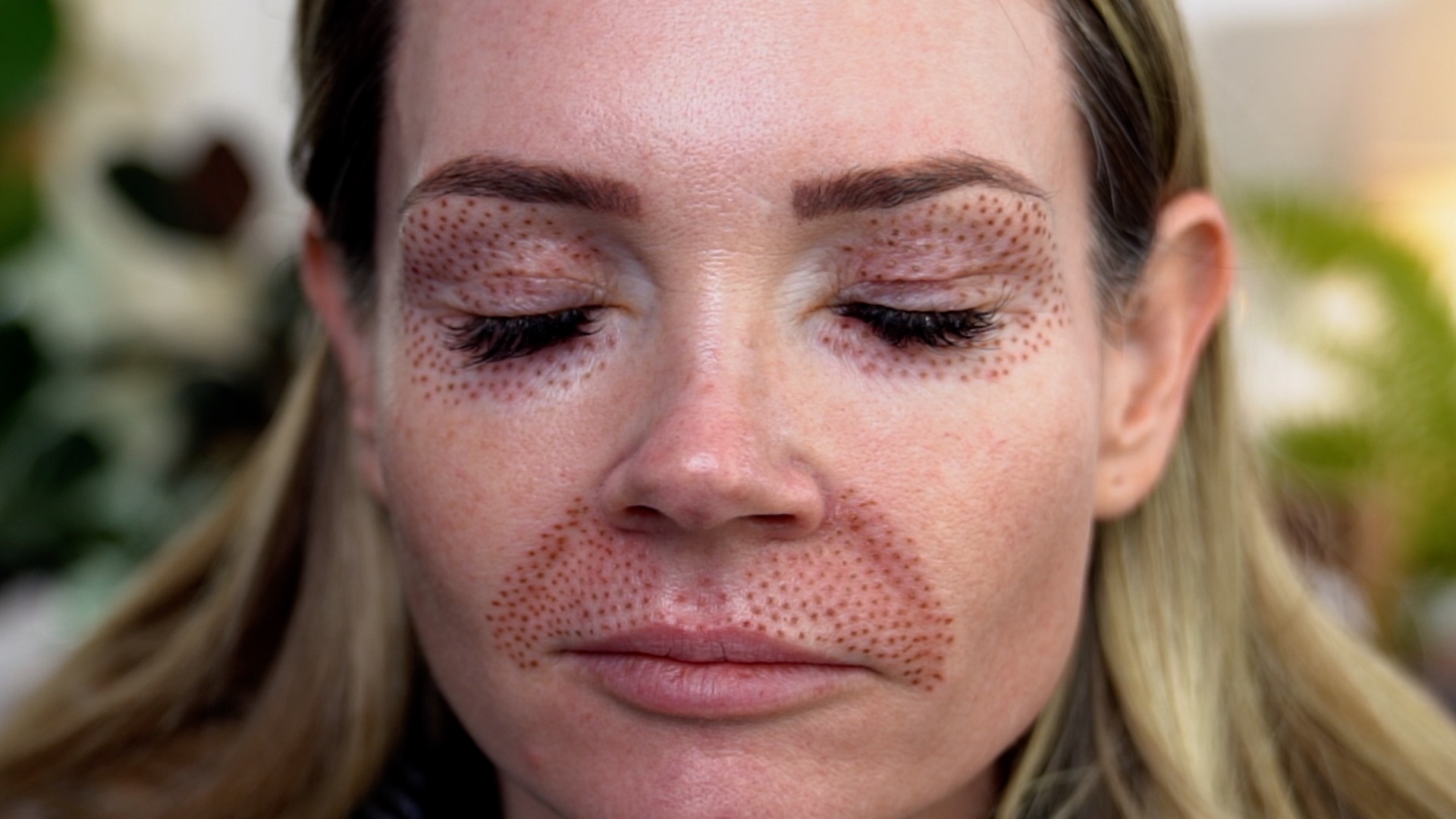 Best Skincare Treatments For Winter - treatment image
