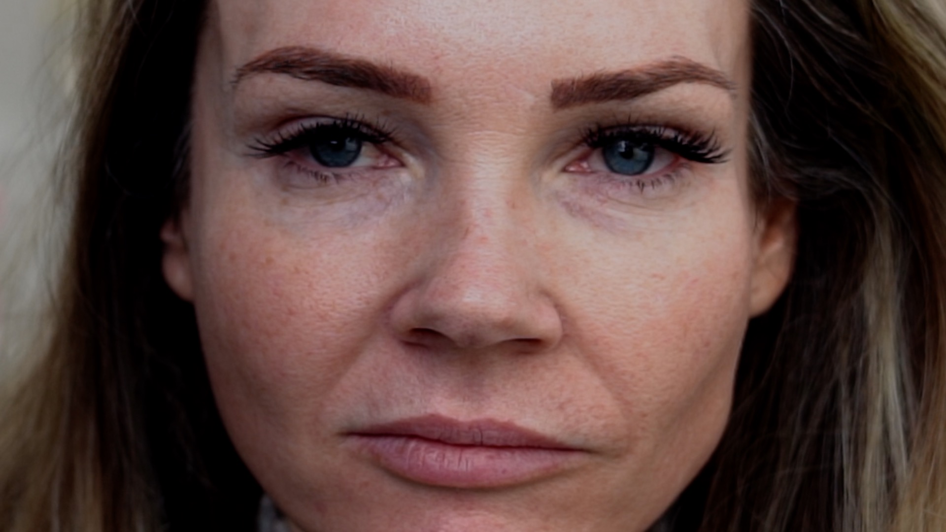 Best Skincare Treatments For Winter - treatment image