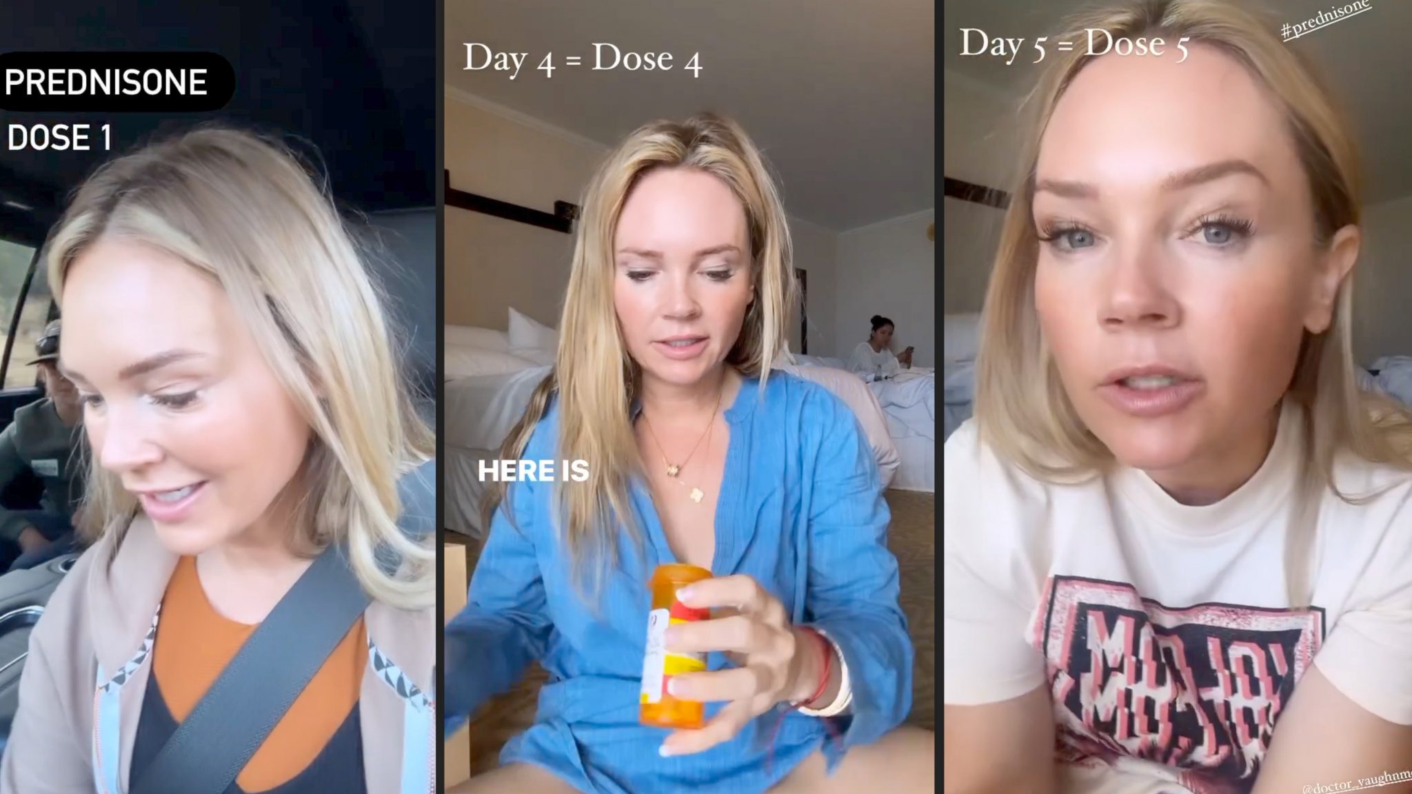 Melanotan 1 vs. 2: My Summer Journey & Real Results - treatment image