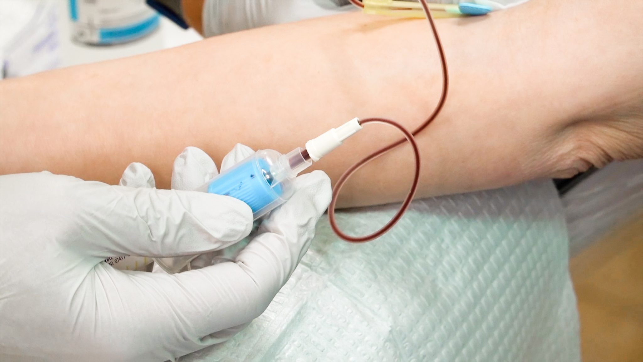 Can you get HIV from a Vampire Facial? Are PRP Injections safe? - treatment image