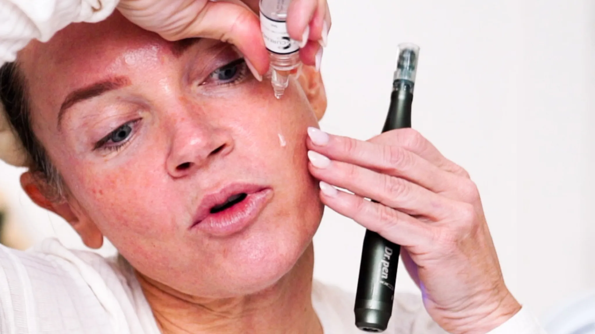 Thanksgiving Glow-Up: Exfoliate & Microneedle for Radiant Skin - treatment image
