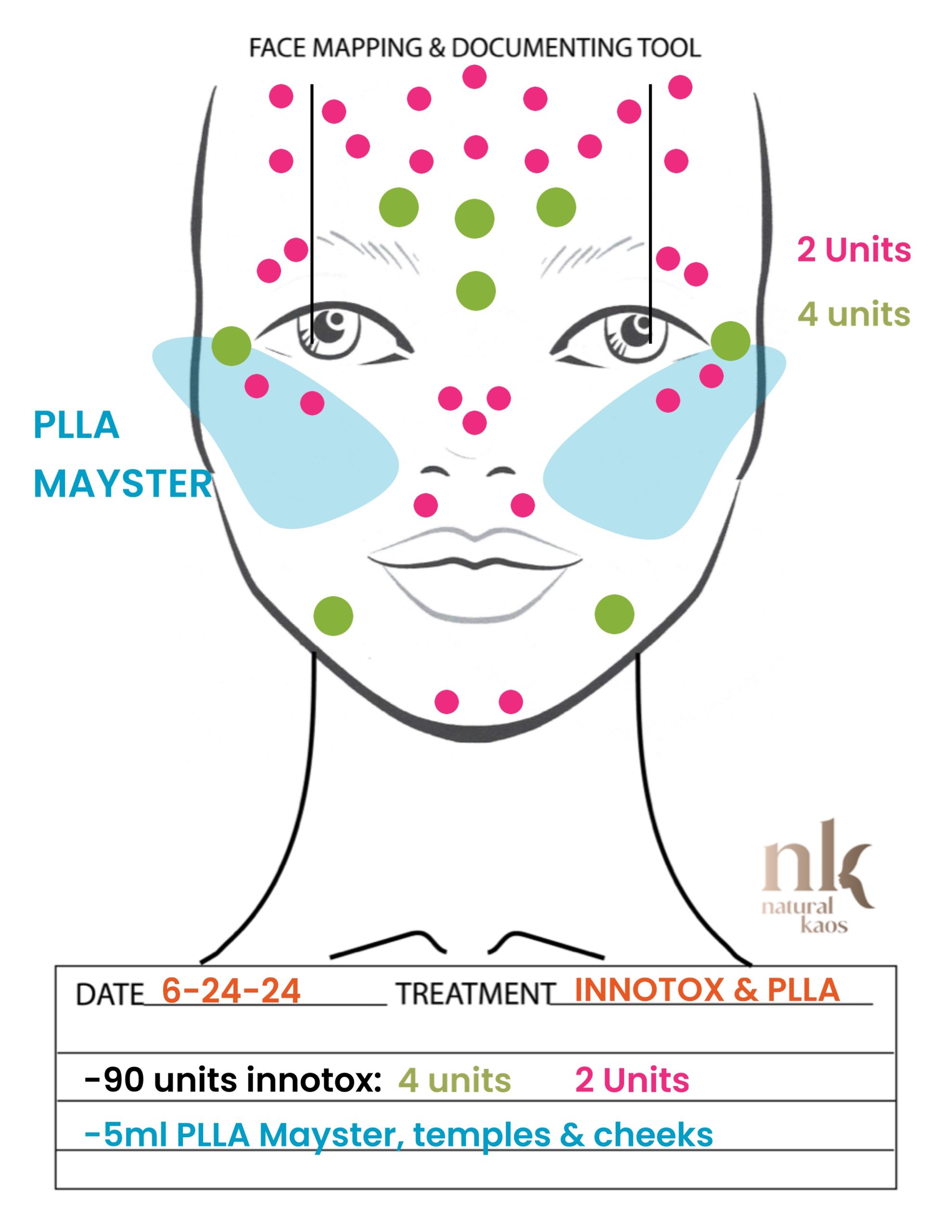 Transform Your Ozempic Face With Innotox And PLLA - treatment image