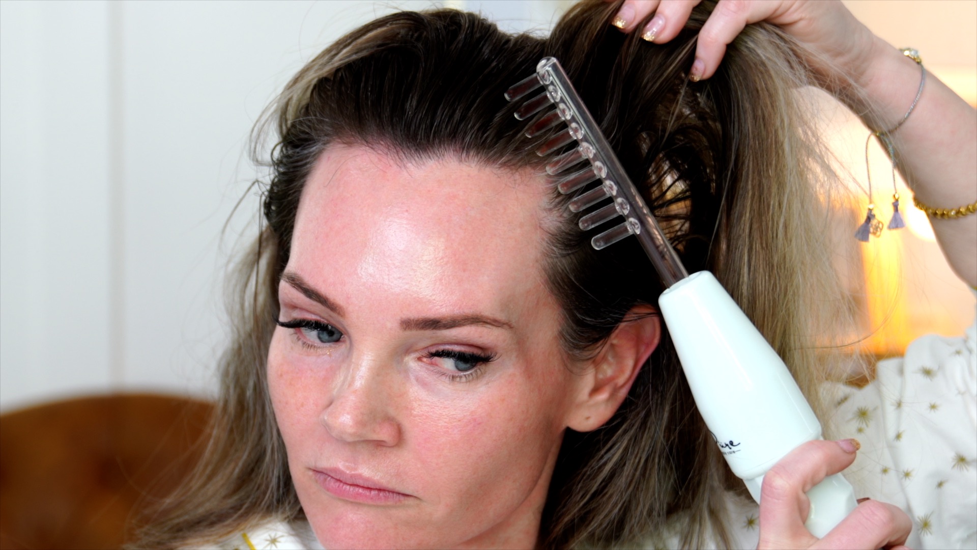 Hair Growth with Microneedling at Home - treatment image