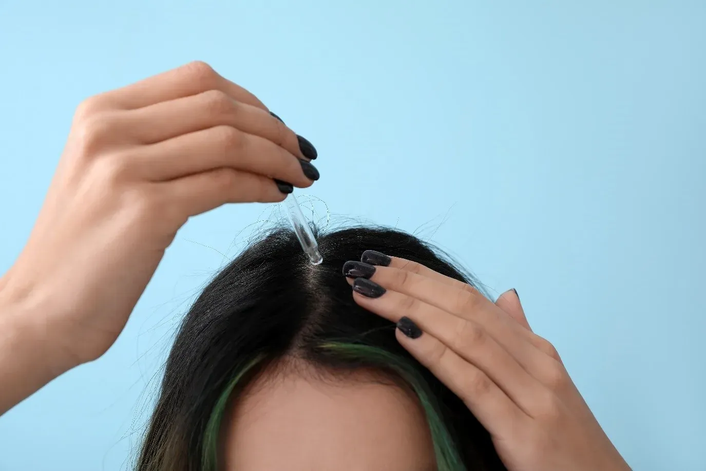 1st Microneedling & HAIRNA Exosome Hair Fill for Thicker, Fuller Hair! - treatment image