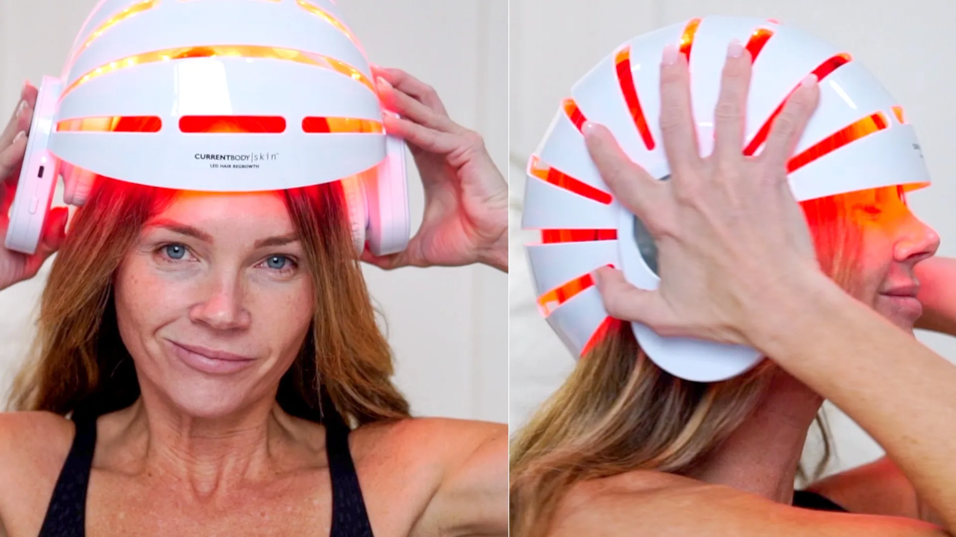 LIVE: Holiday Glow-Up with Glycolic Mask & Microneedling Dr. Pen + Curenex - treatment image