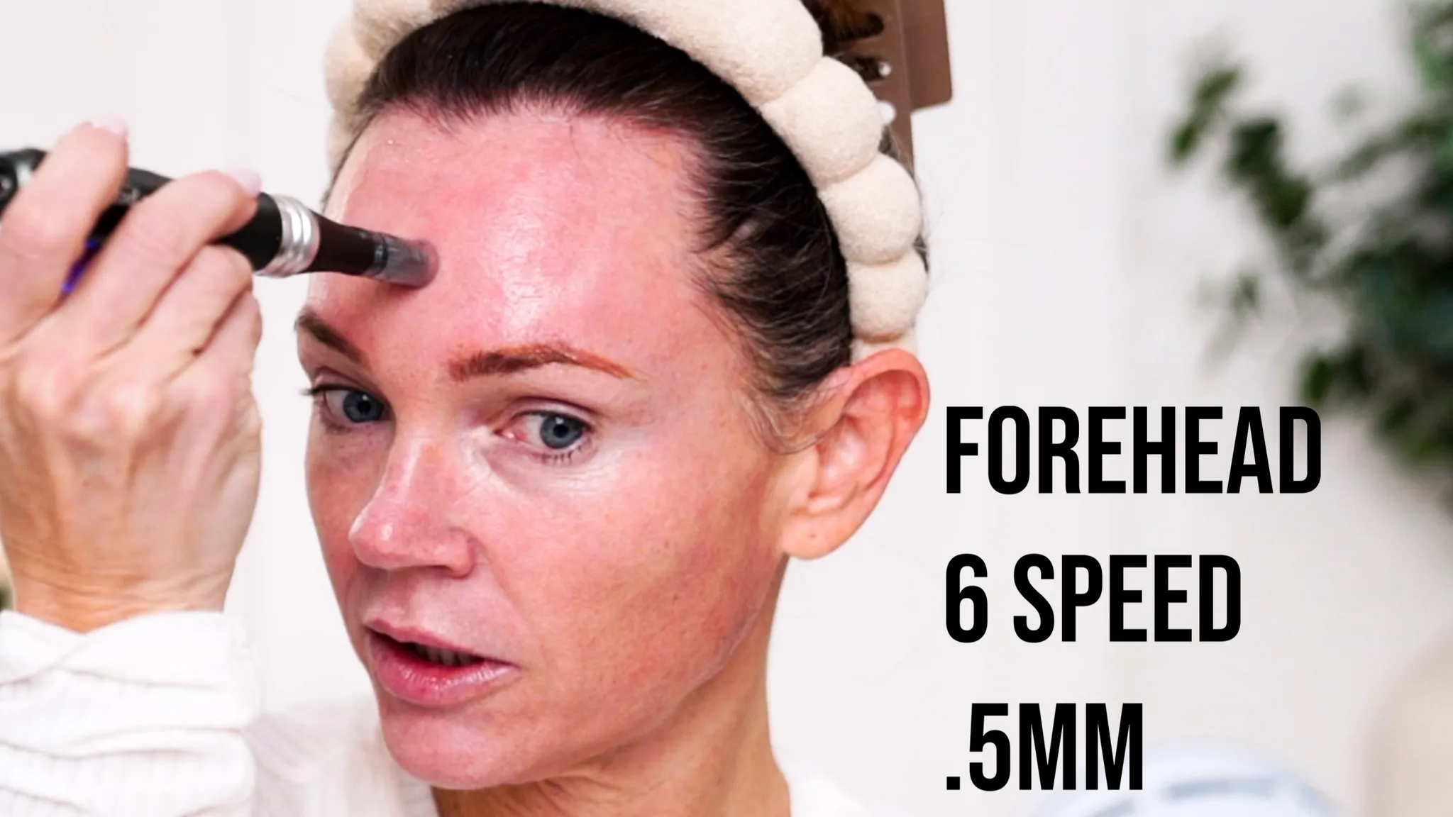 Thanksgiving Glow-Up: Exfoliate & Microneedle for Radiant Skin - treatment image