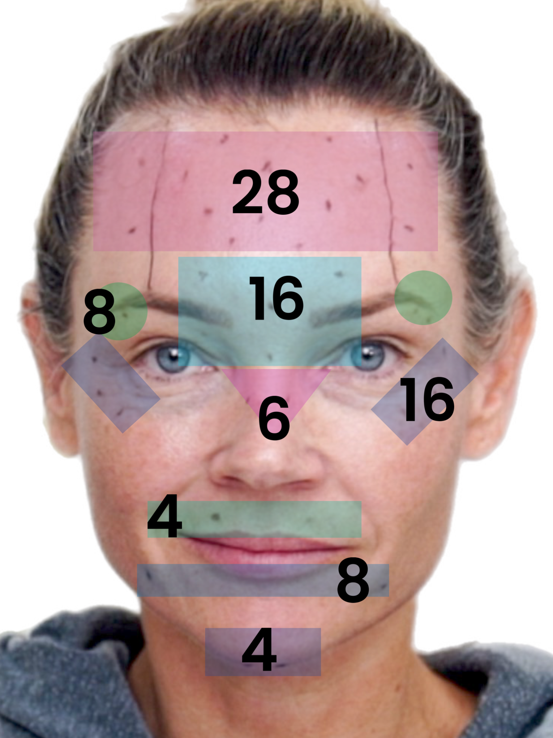 Transform Your Ozempic Face With Innotox And PLLA - treatment image