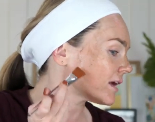 MATRIGEN B-TOX PEEL REVIEW