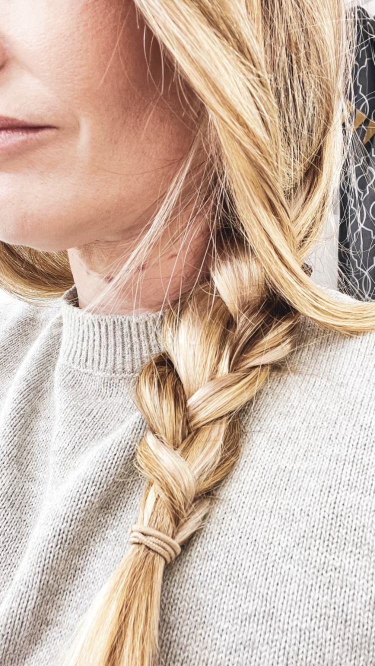 Luxy Hair Extensions & Covering Mesothearpy Bruising - treatment image