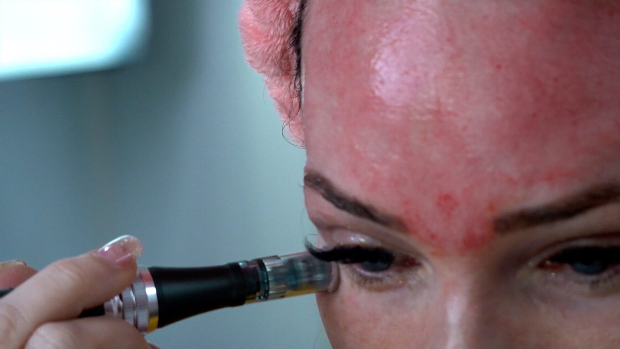 Microneedling with Derma-E Serum! Plus Sheet Mask Tip