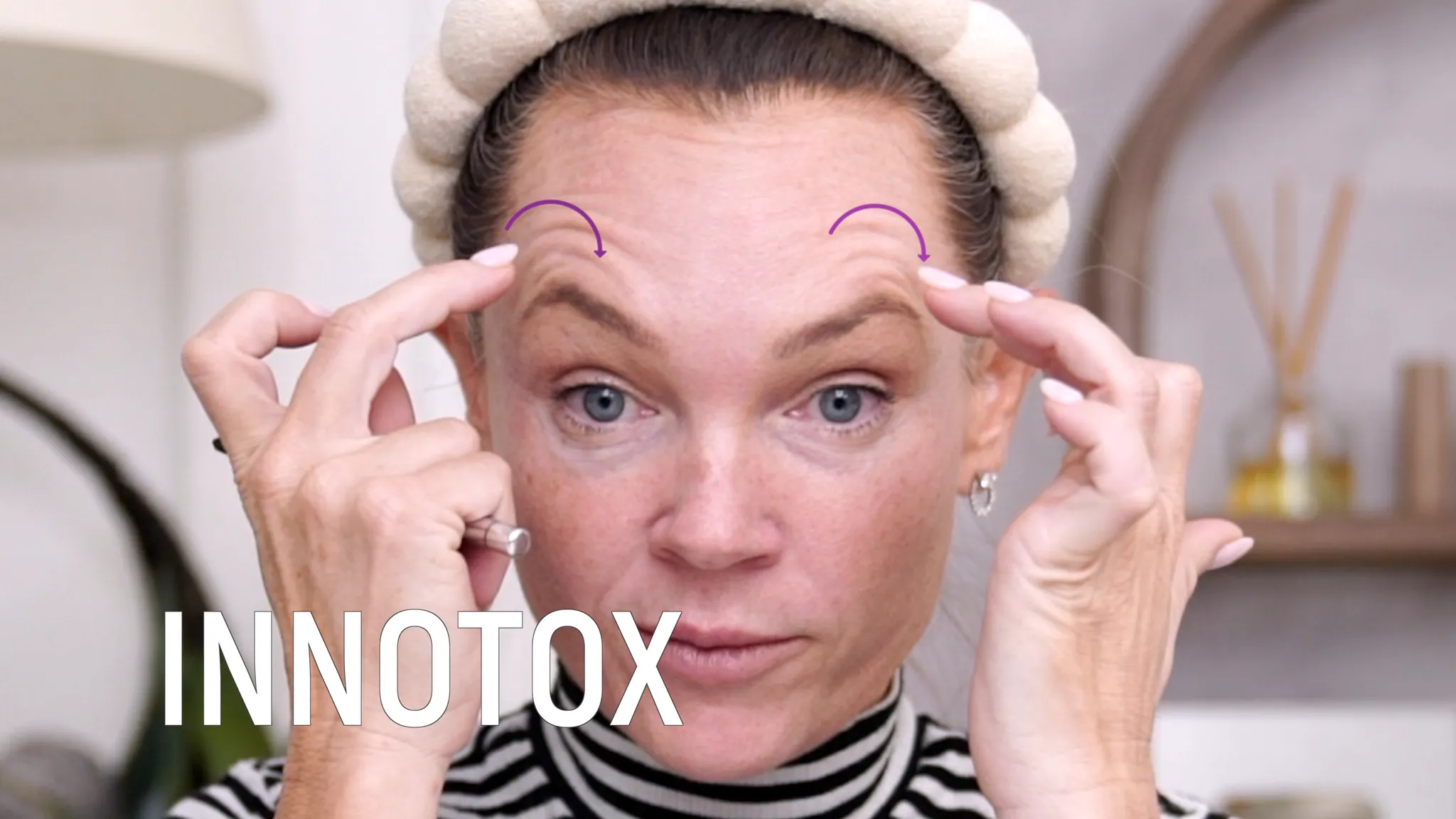 Biostimulators: How to Build Face Volume with Mayster PLLA & Gouri - treatment image