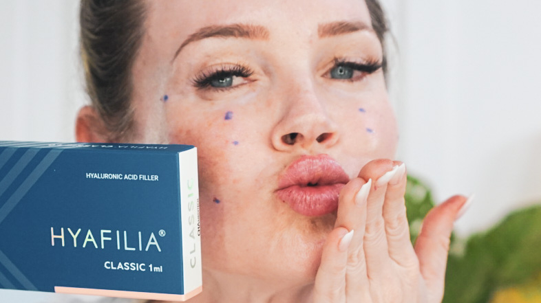 Gouri PCL and Hyafillia Lip Filler - treatment image