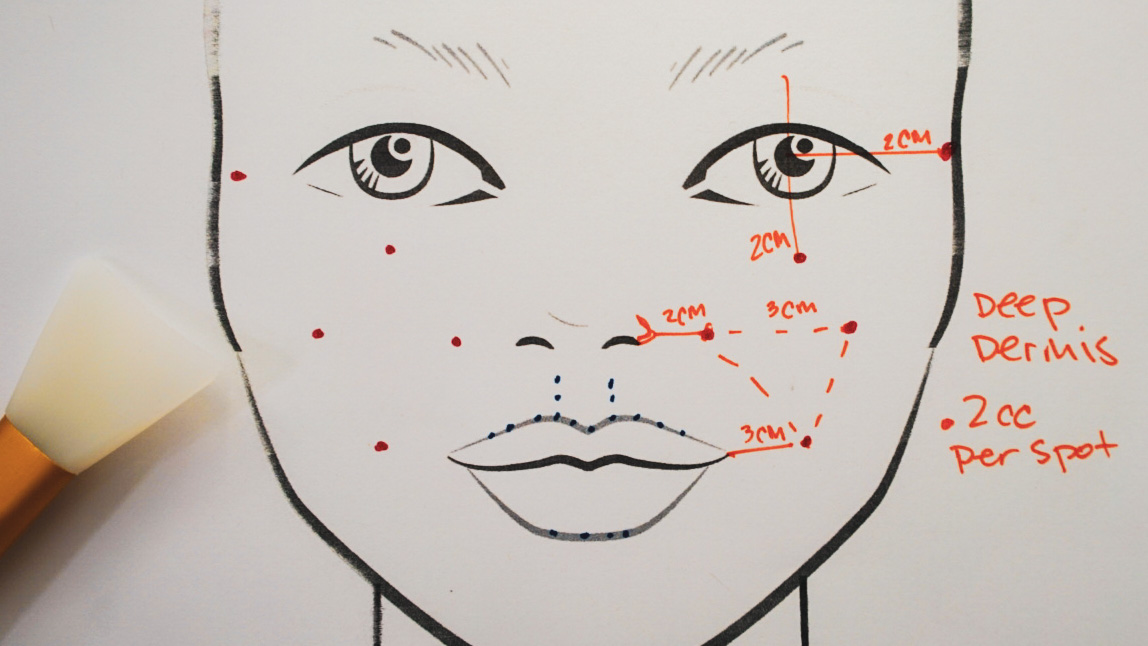 Gouri, HP Cell Regation & Lip Filler - treatment image