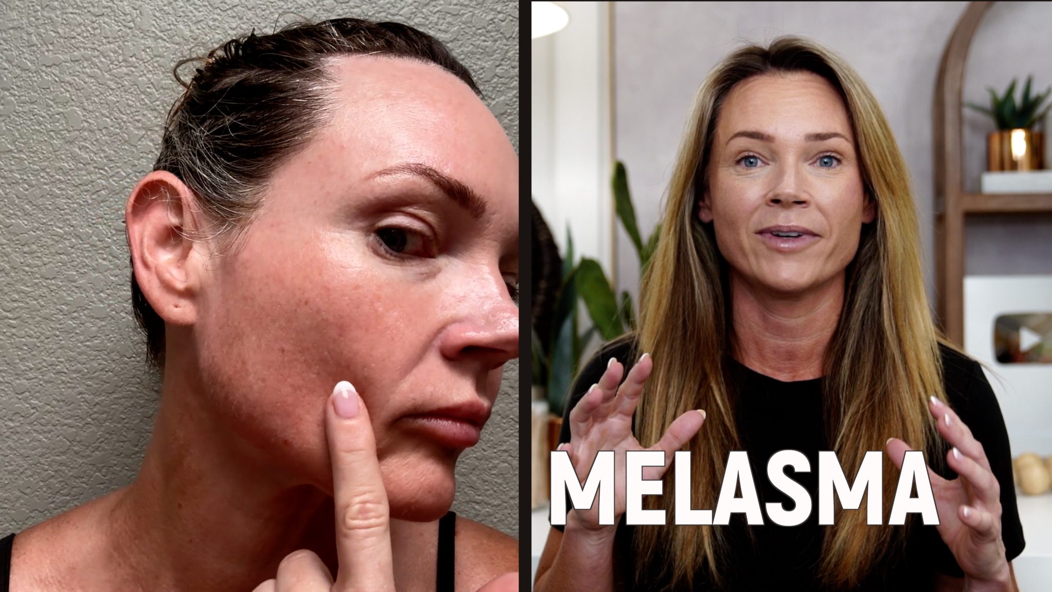 Melanotan 1 vs. 2: My Summer Journey & Real Results - treatment image