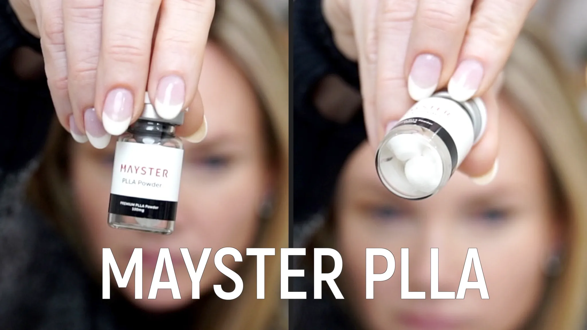Biostimulators: How to Build Face Volume with Mayster PLLA & Gouri - treatment image