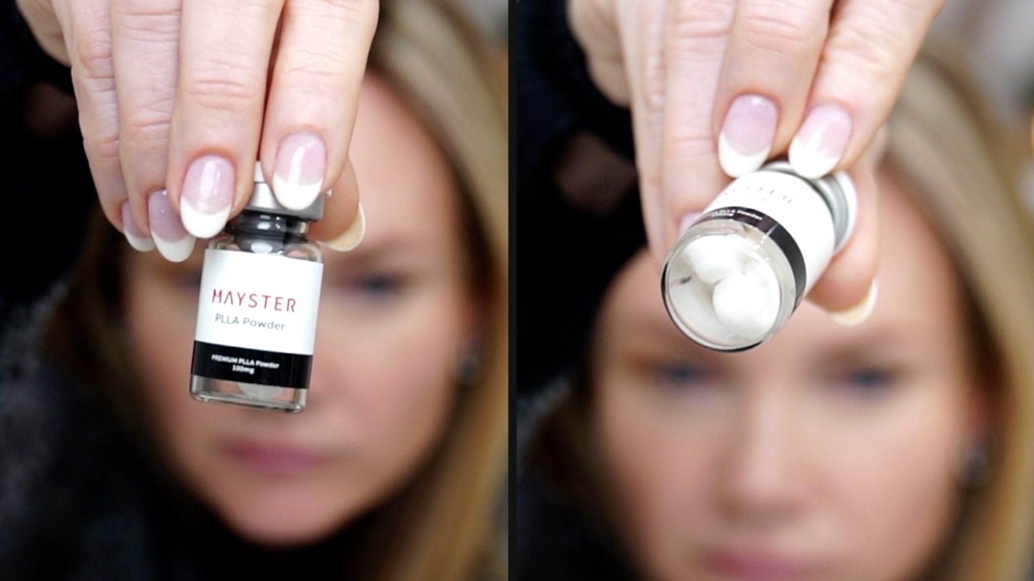 MAYSTER PLLA - treatment image