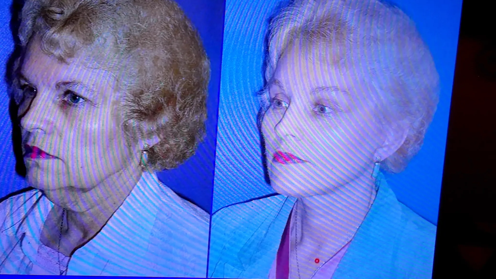 Do I Need a Facelift? Join Me for My Consultation Experience & Cost! - treatment image