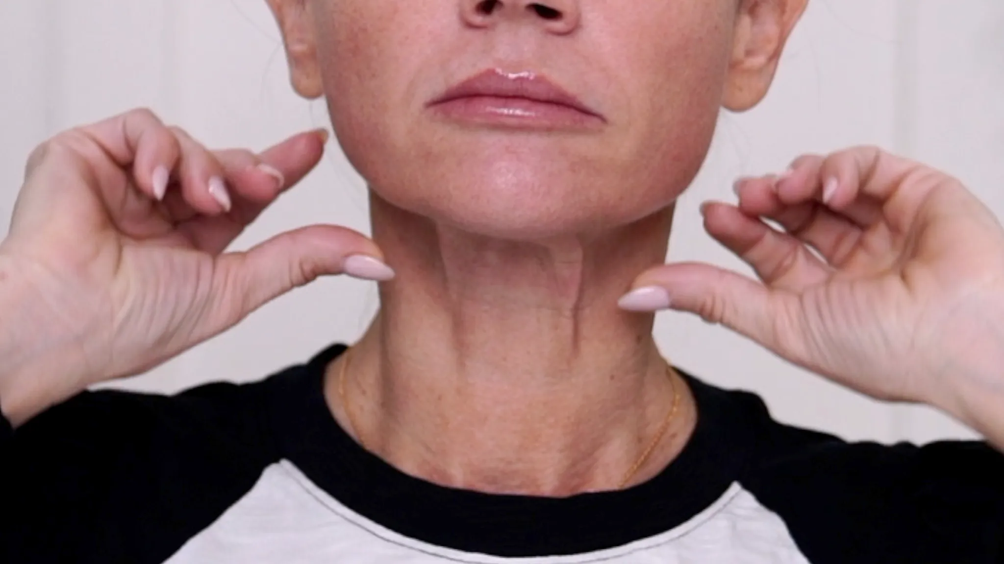 Do I Need a Facelift? Join Me for My Consultation Experience & Cost! - treatment image