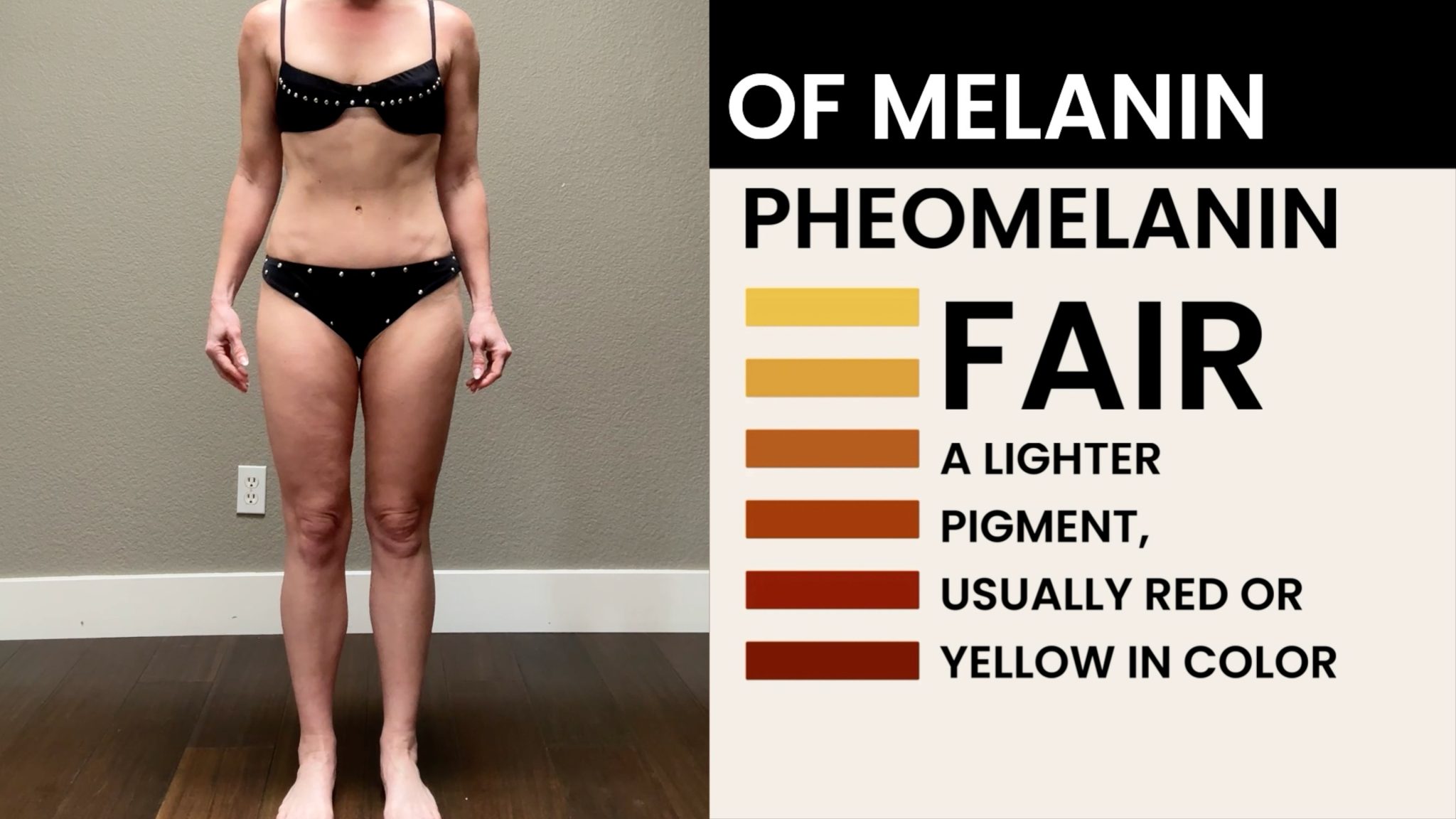 Using Melanotan to Prevent Polymorphous Light Eruption aka SUN POISONING - treatment image