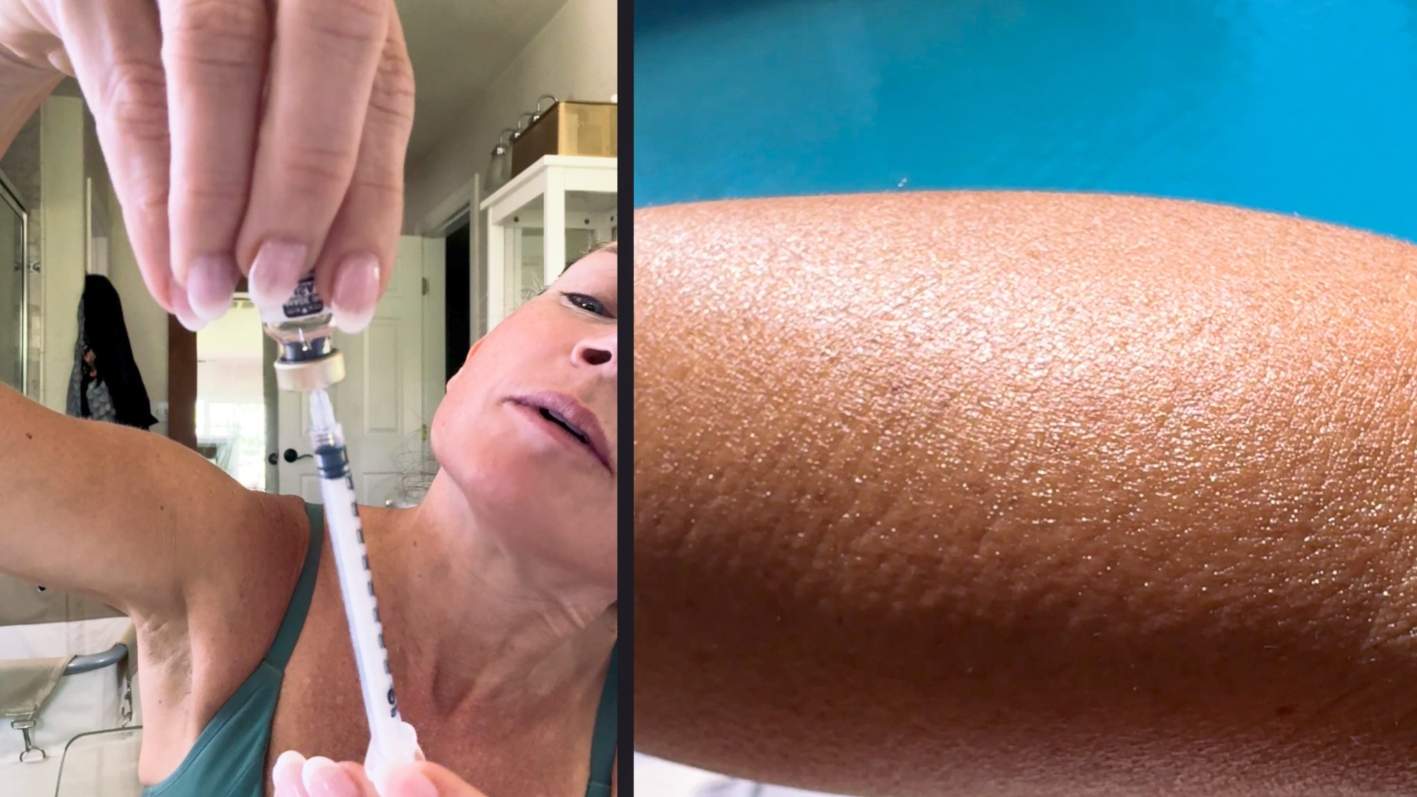 Melanotan 1 vs. 2: My Summer Journey & Real Results - treatment image