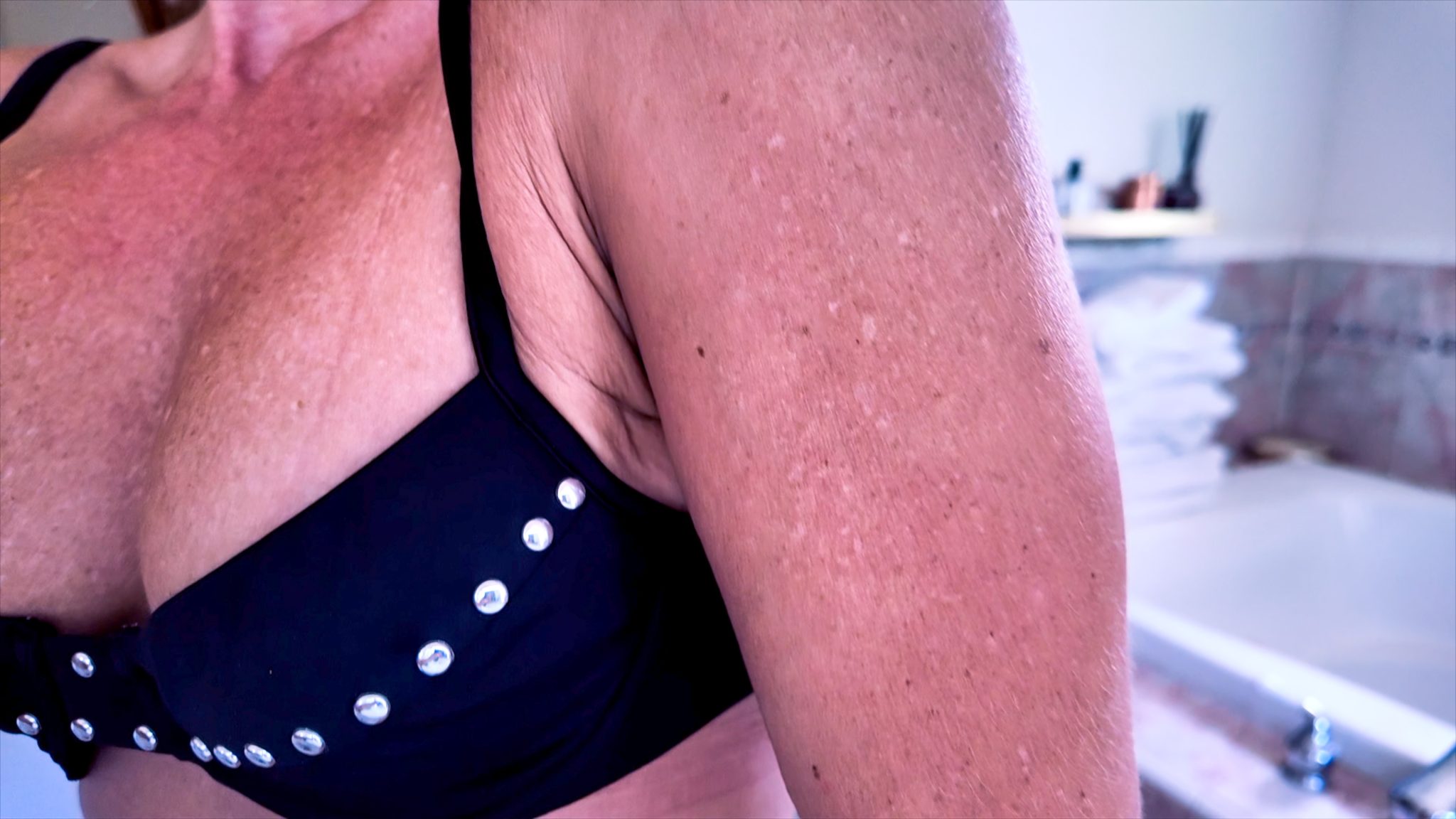 Melanotan 1 vs. 2: My Summer Journey & Real Results - treatment image