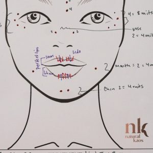 Innotox Injections and Lip Filler (Petite) - treatment image