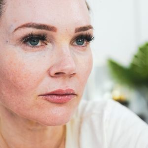 Innotox Injections and Lip Filler (Petite) - treatment image
