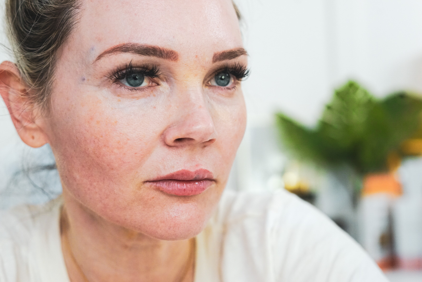 Gouri, HP Cell Regation & Lip Filler - treatment image