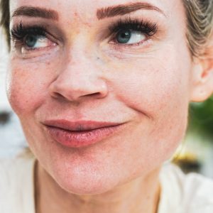 Innotox Injections and Lip Filler (Petite) - treatment image