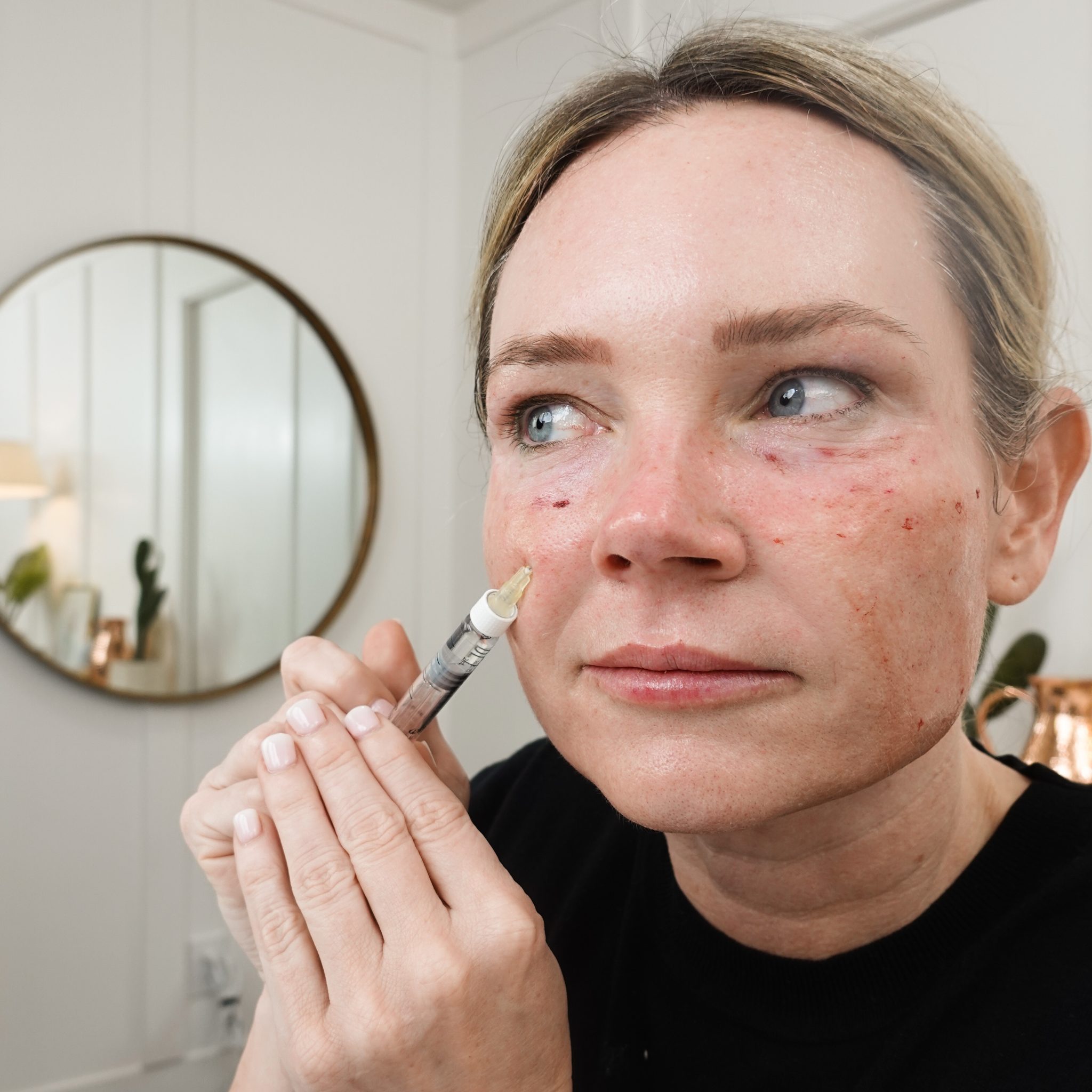 REJURAN HEALER | DERMAHEAL EYE BAG SOLUTION - treatment image