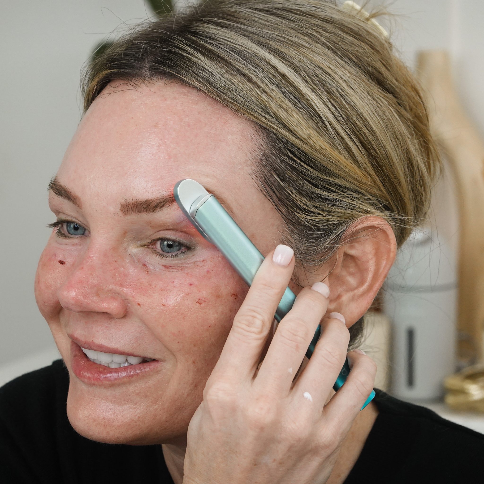 REJURAN HEALER | DERMAHEAL EYE BAG SOLUTION - treatment image