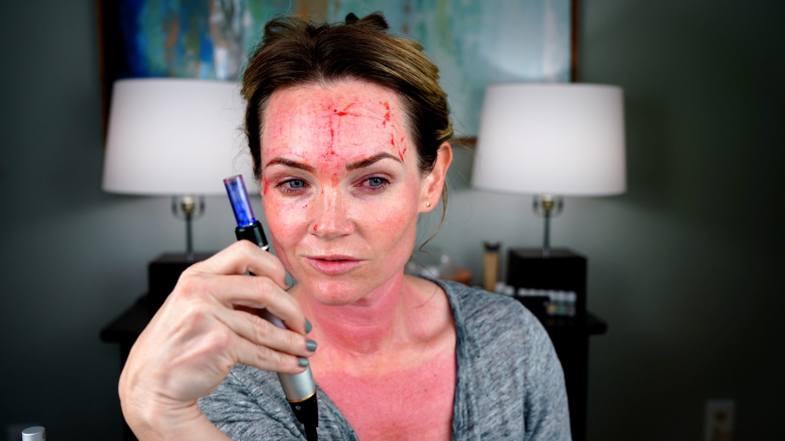 Best Skincare Treatments For Winter - treatment image