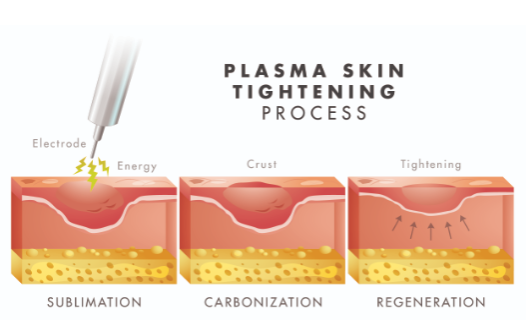 Best Skincare Treatments For Winter - treatment image