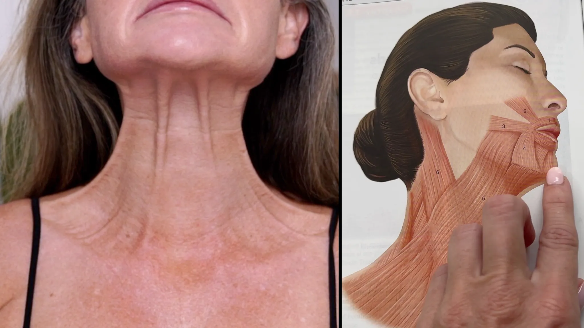 Do I Need a Facelift? Join Me for My Consultation Experience & Cost! - treatment image