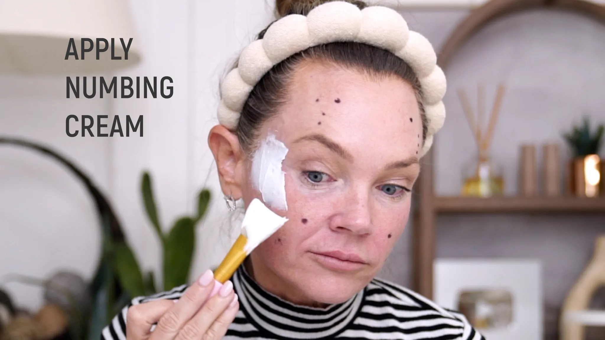 Biostimulators: How to Build Face Volume with Mayster PLLA & Gouri - treatment image