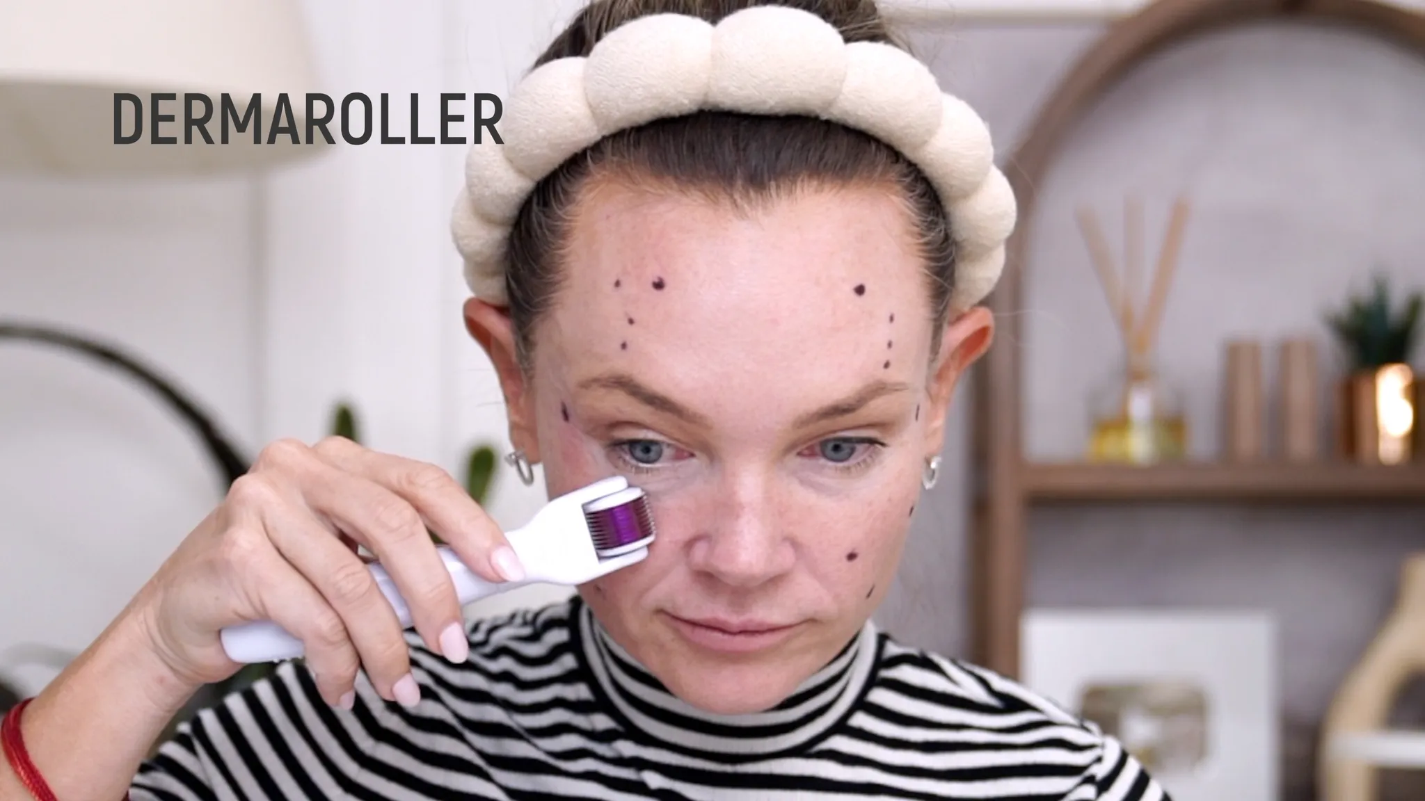 Biostimulators: How to Build Face Volume with Mayster PLLA & Gouri - treatment image