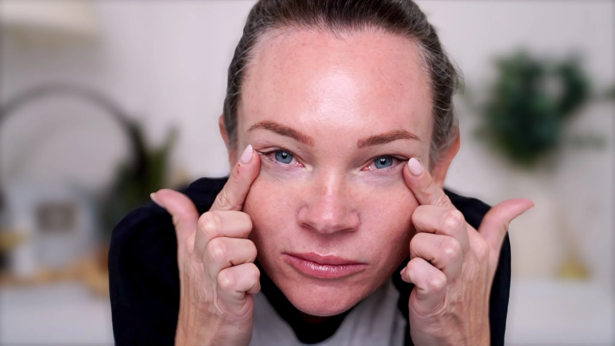 Do I Need a Facelift? Join Me for My Consultation Experience & Cost! - treatment image