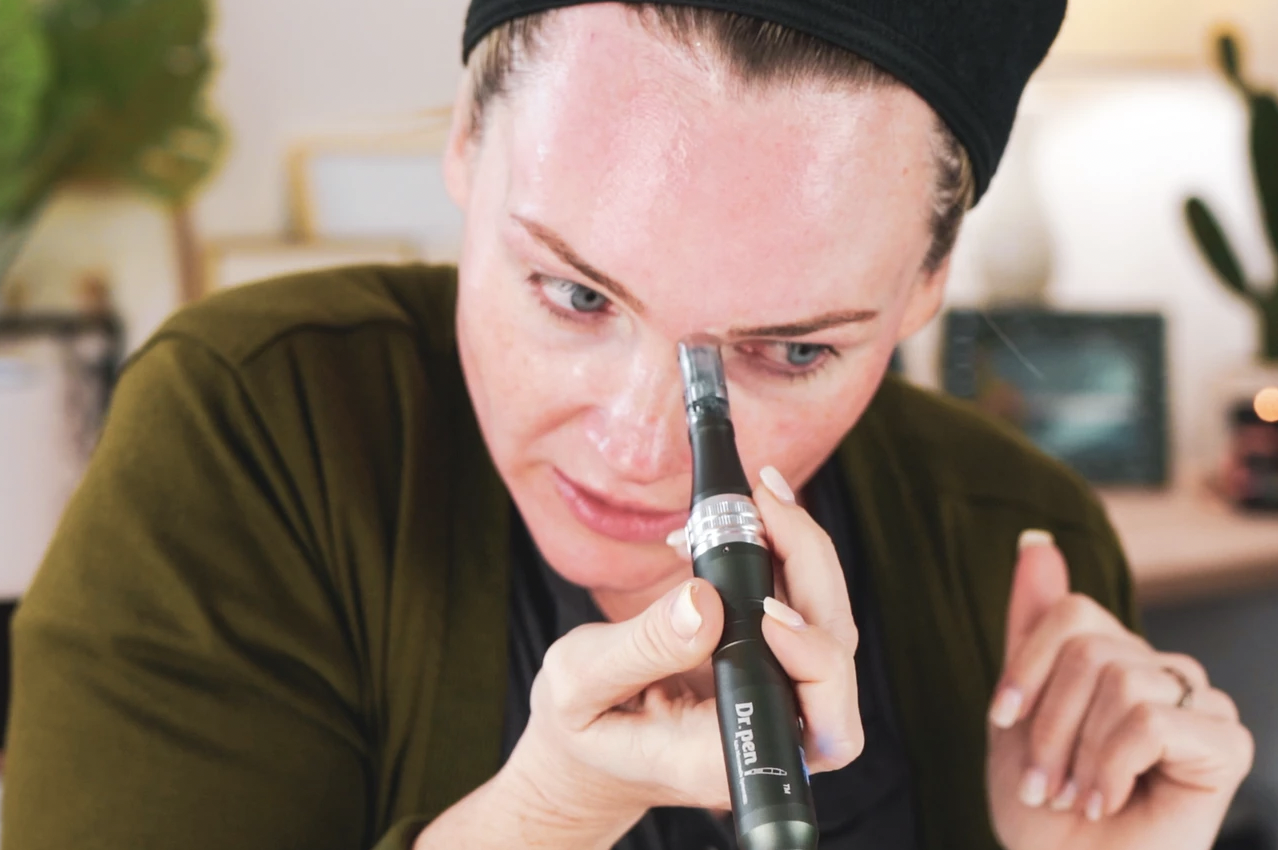MICRONEEDLING 101 - treatment image