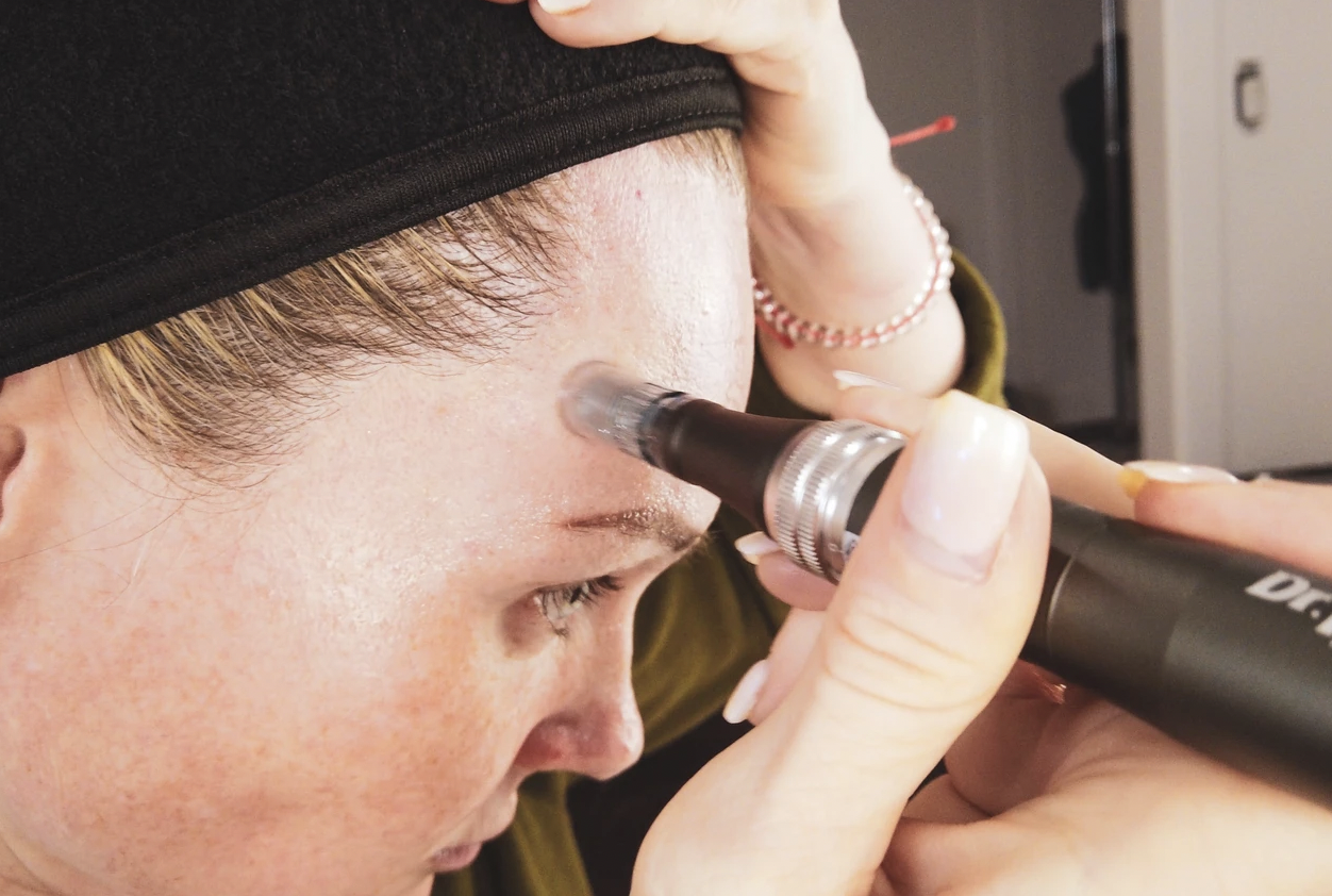Best Skincare Treatments For Winter - treatment image