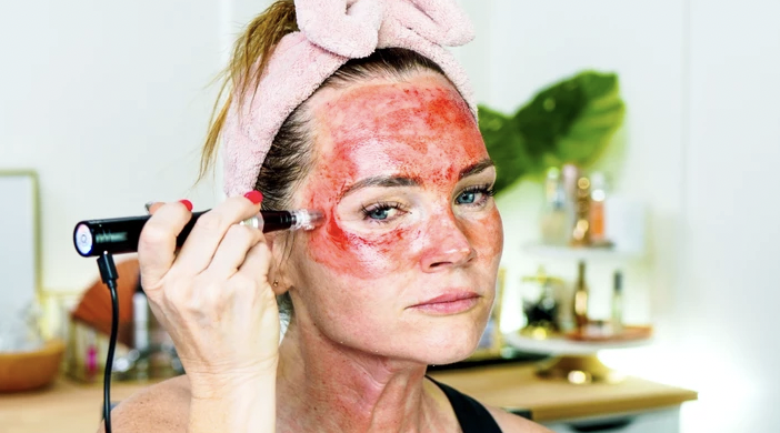 MICRONEEDLING 101 - treatment image
