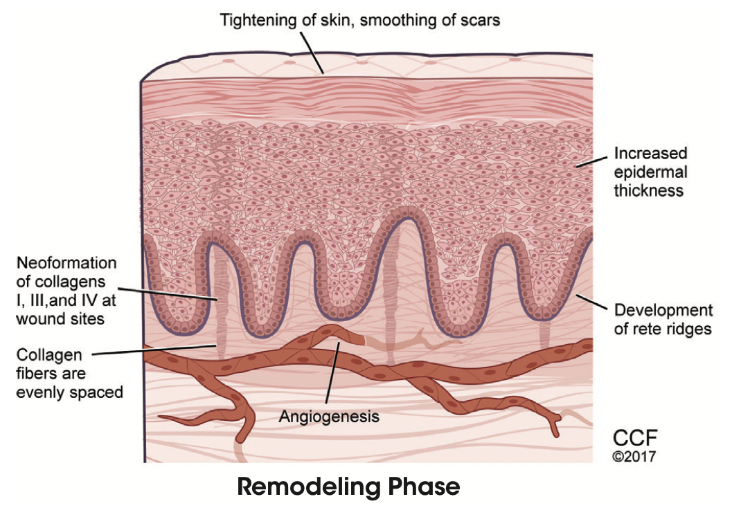 Best Skincare Treatments For Winter - treatment image